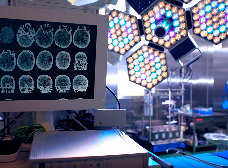 Ressecção de extensão: por que remover mais tumor pode melhorar a sobrevida?